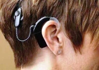 Applications invited for free cochlear implant surgery for hearing-impaired children up to 5 years of age.